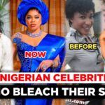 The truth no one told Nigerian women about skin bleaching. It will disappoint them