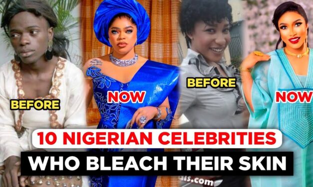 The truth no one told Nigerian women about skin bleaching. It will disappoint them